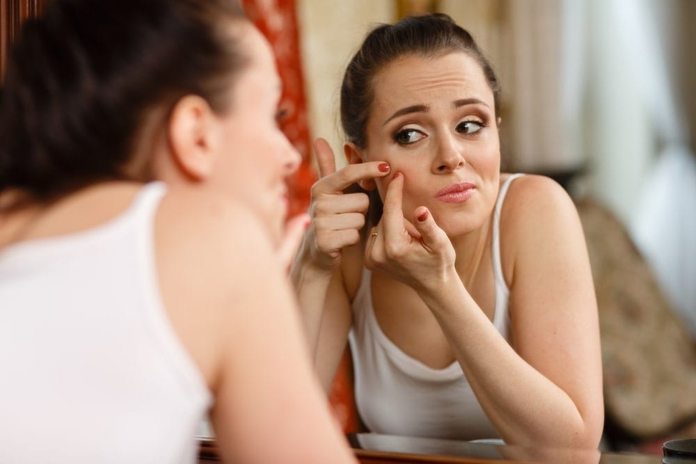 Roaccutane en el mostrador