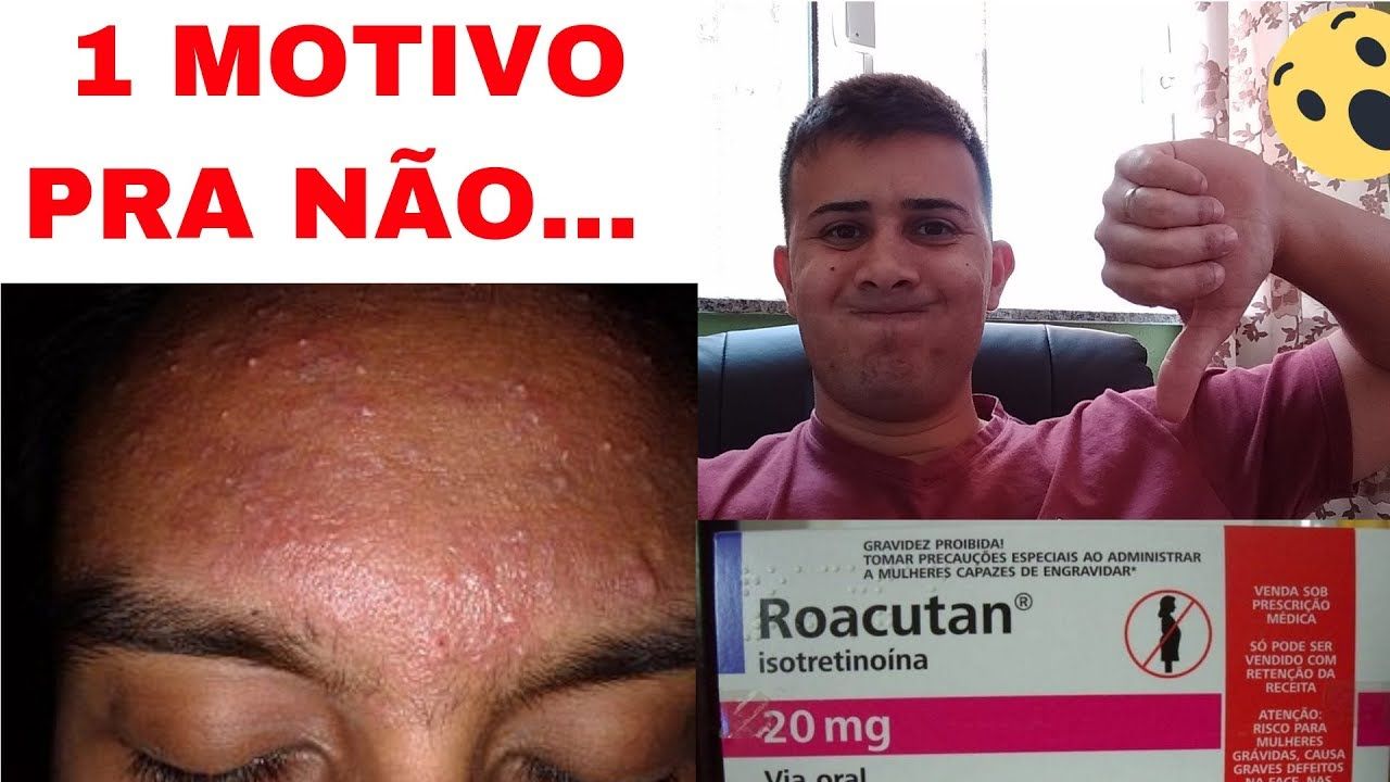 Precio de roacutan de 20mg